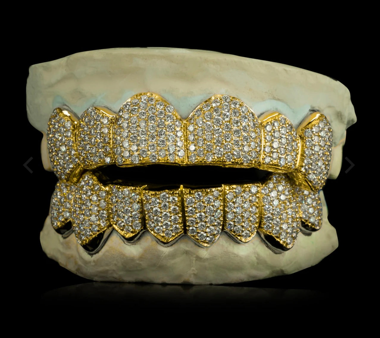 Custom VVS D Color Moissanite Grillz (Gold)