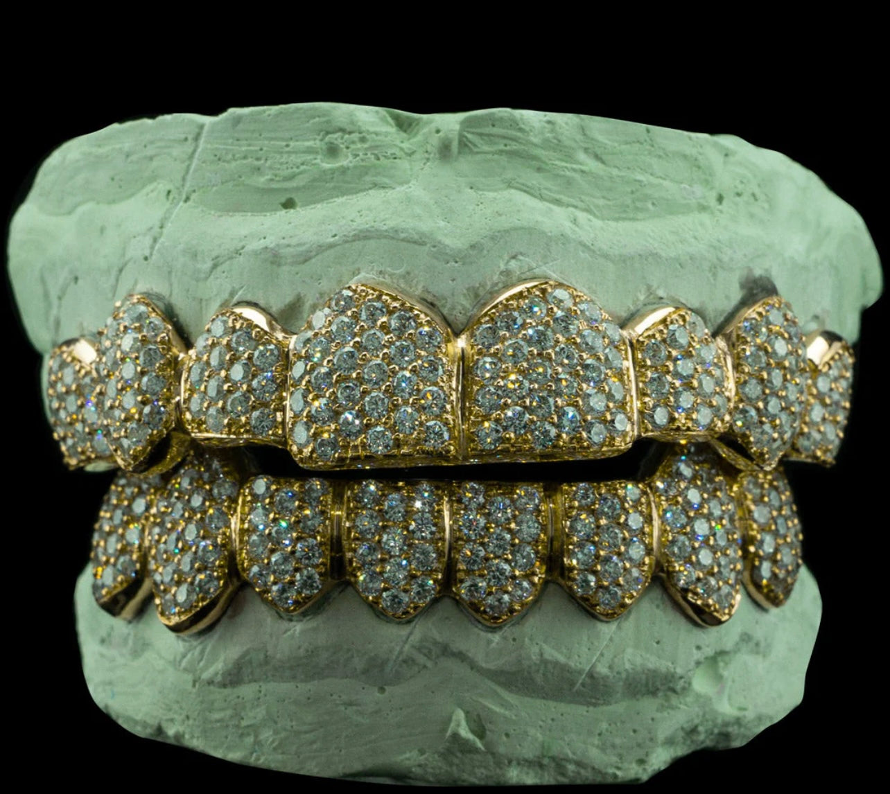 Custom VVS D Color Moissanite Grillz (Gold)