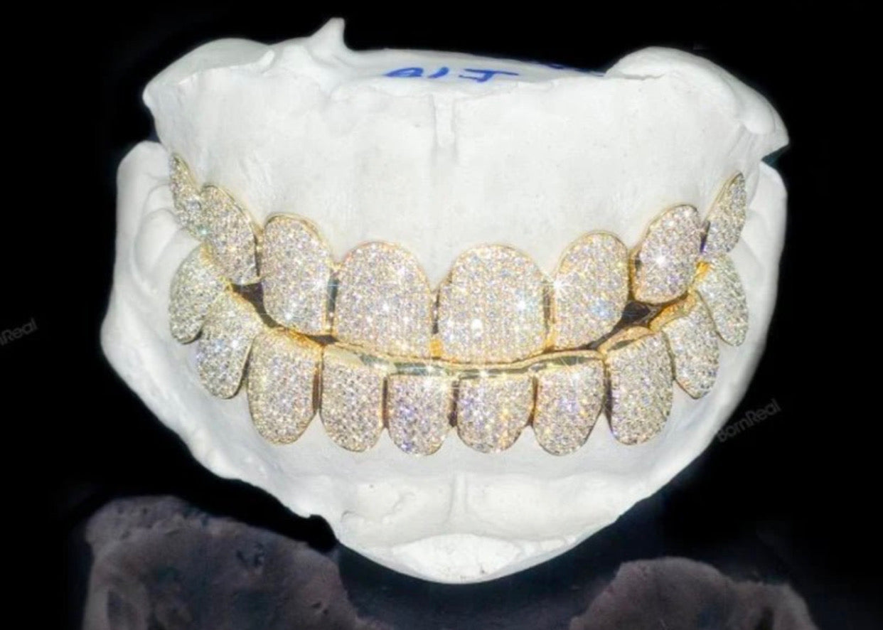 Custom VVS D Color Moissanite Grillz (Gold)